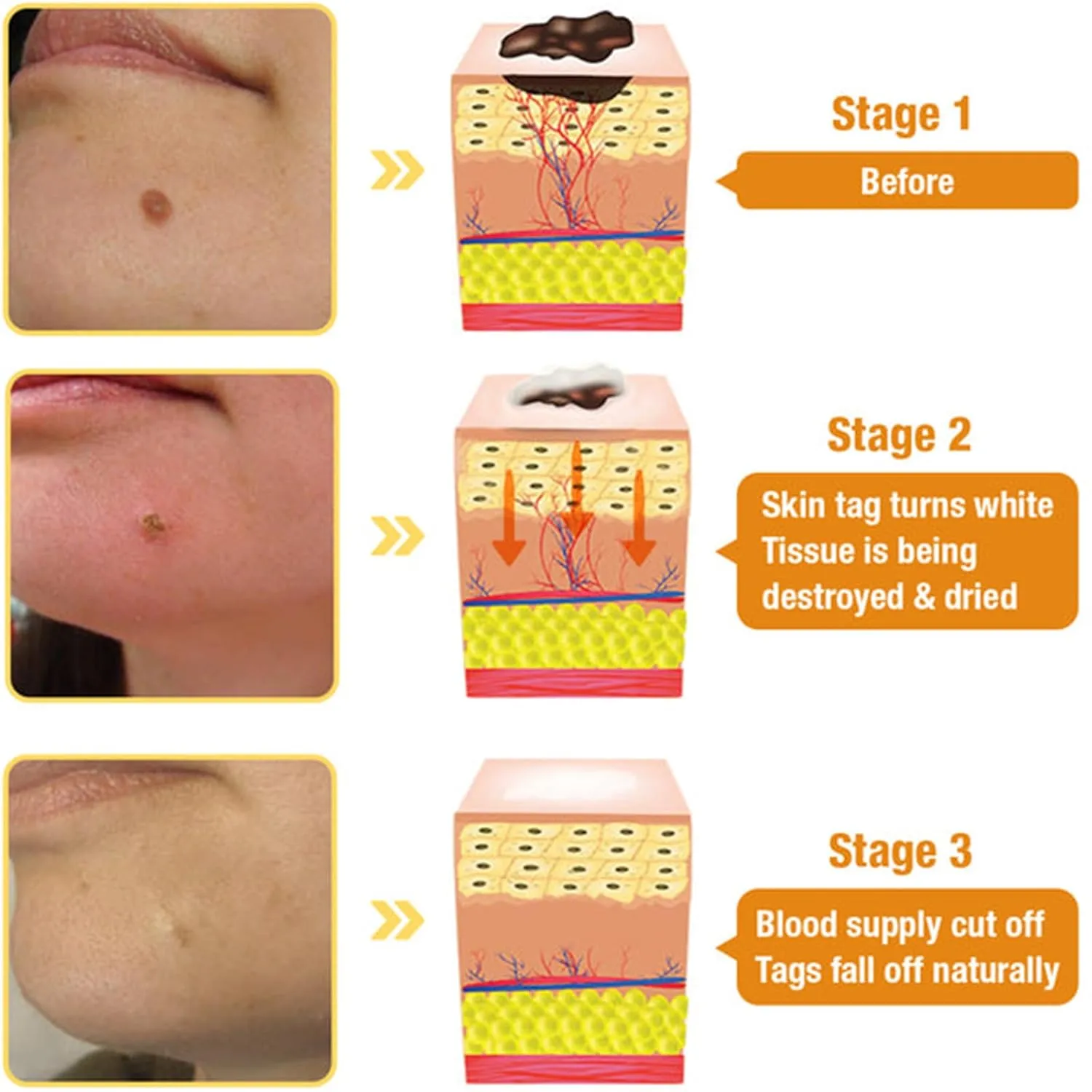 Bee Venom Skin Treatment Cream, Bee Venom Treatment Cream, Professional Bee Venom Repair Cream, Bee Venom Cream for All Body Parts (2PCS)