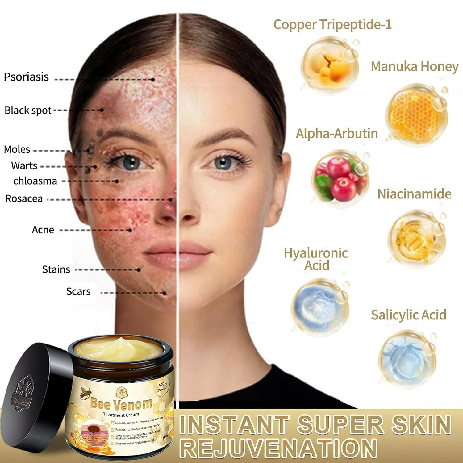Bee Venom Skin Treatment Cream, Bee Venom Treatment Cream, Professional Bee Venom Repair Cream, Bee Venom Cream for All Body Parts (2PCS)