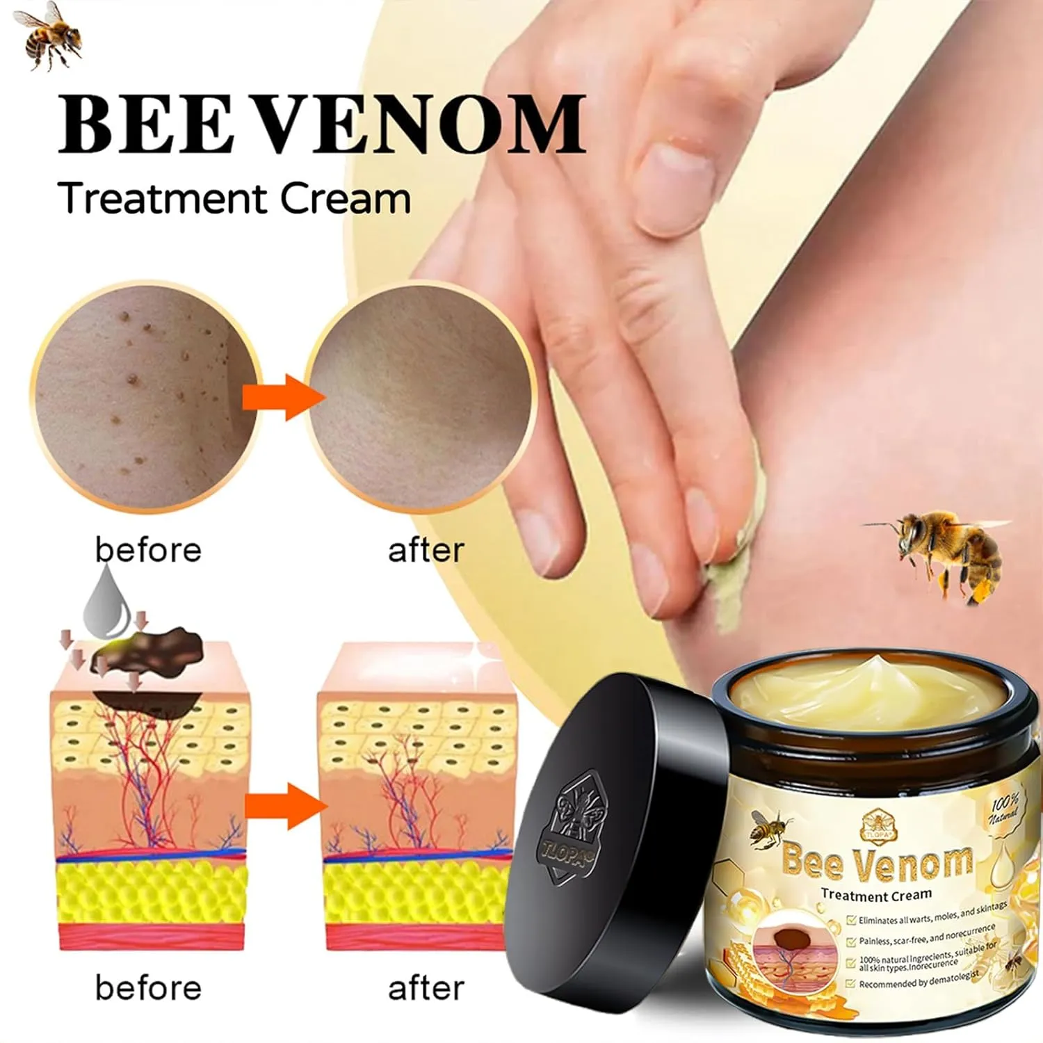 Bee Venom Skin Treatment Cream, Bee Venom Treatment Cream, Professional Bee Venom Repair Cream, Bee Venom Cream for All Body Parts (2PCS)