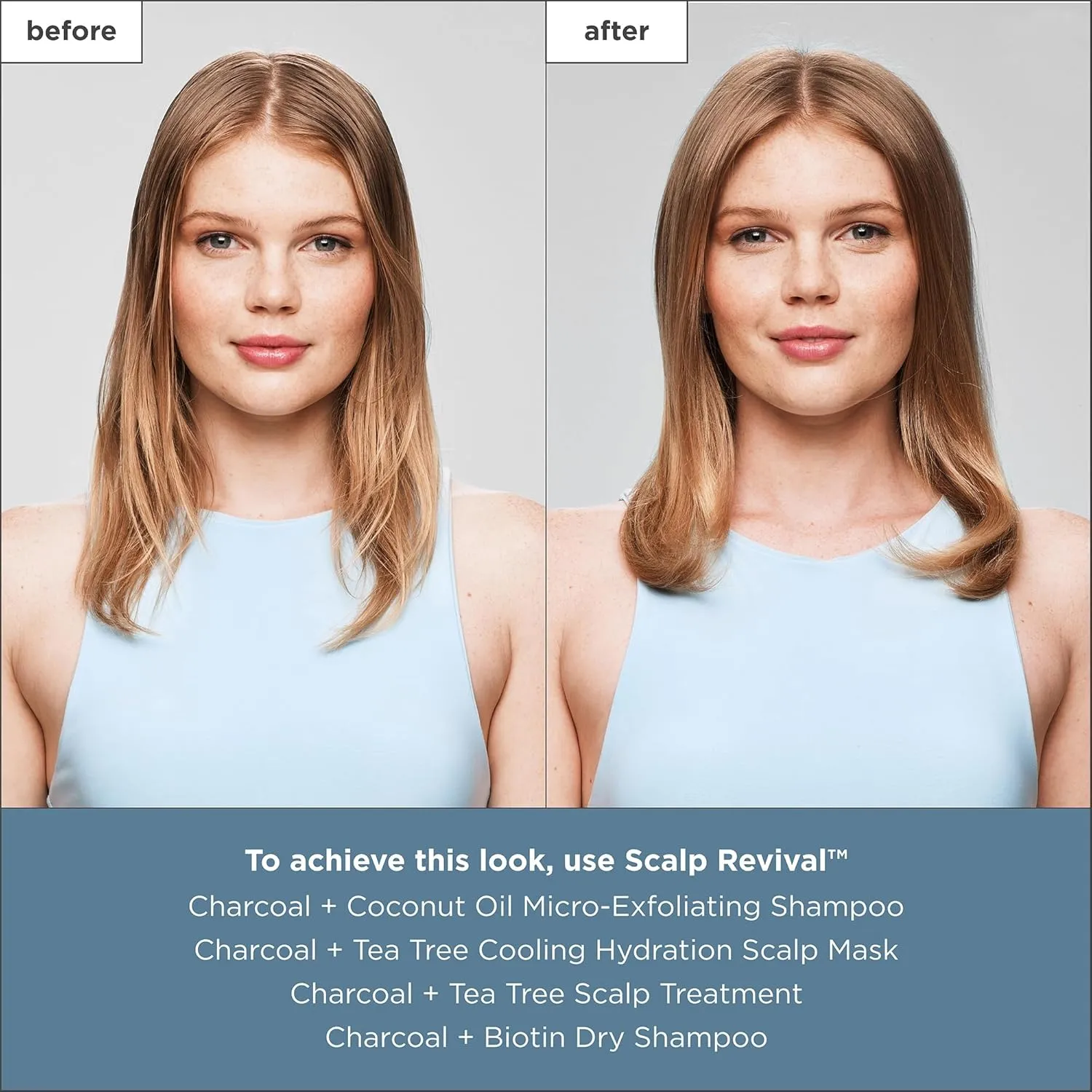 Briogeo Scalp Revival Soothe   Detoxify Minis Kit, Soothe a Dry, Flaky, Itchy Scalp, Clarify Build Up, Scalp Detox, Unclog Hair Follicles,Travel Kit, Vegan, Cruelty-Free, 4-Piece Set